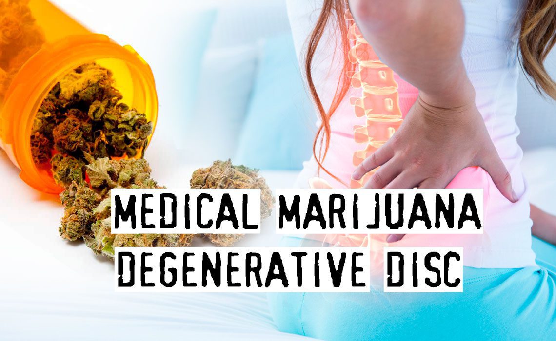 You are currently viewing Medical Marijuana To Deal With Degenerative Disc Disease, Effective Or Not?