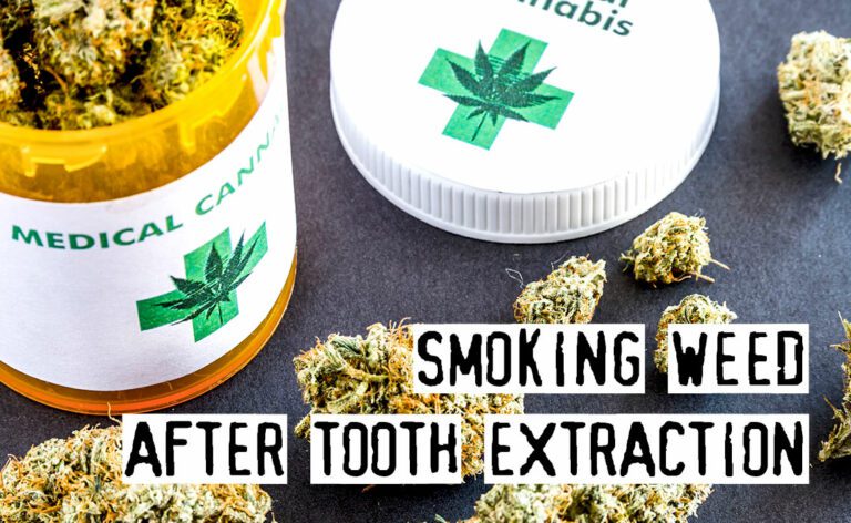 Smoking Weed After Tooth Extraction - Best Pot Delivery